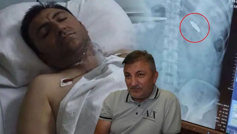 15 Temmuz'un İzleri: Vücudunda Kurşunla Hayatta Kalan Bir Kahraman